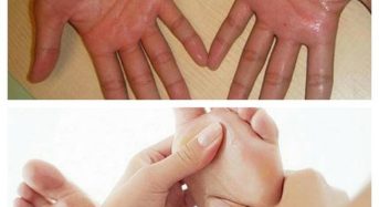 MỒ HÔI TAY CHÂN NHIỀU THỬ NGAY CÁCH NÀY