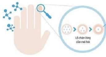 TRỊ MỒ HÔI TOÀN THÂN BẰNG MÁY LIPLOP